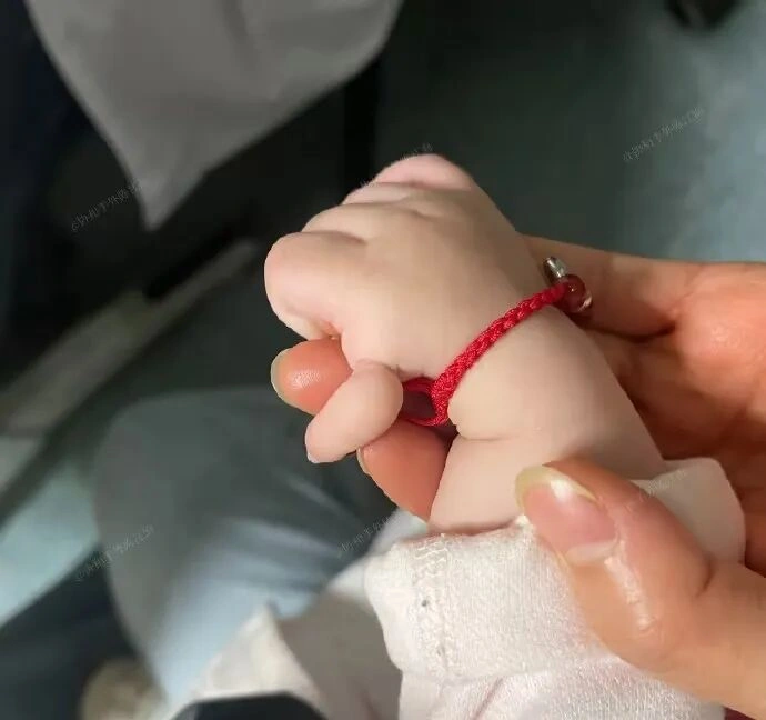 宝宝的拇指只能切掉吗?漂浮拇怎么才能保下来?