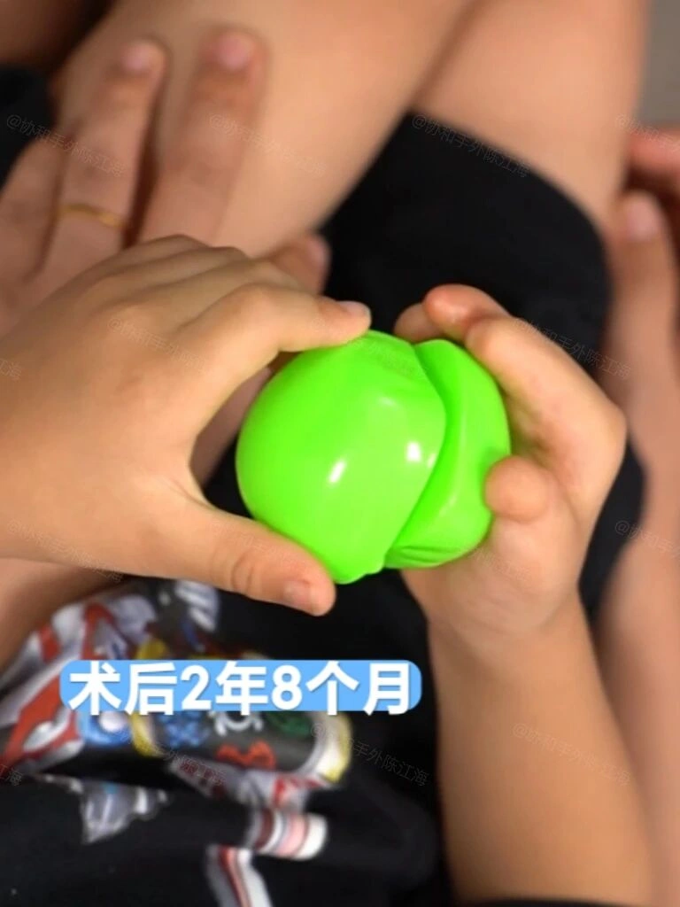 出生没有5指，还能无中生有吗？
