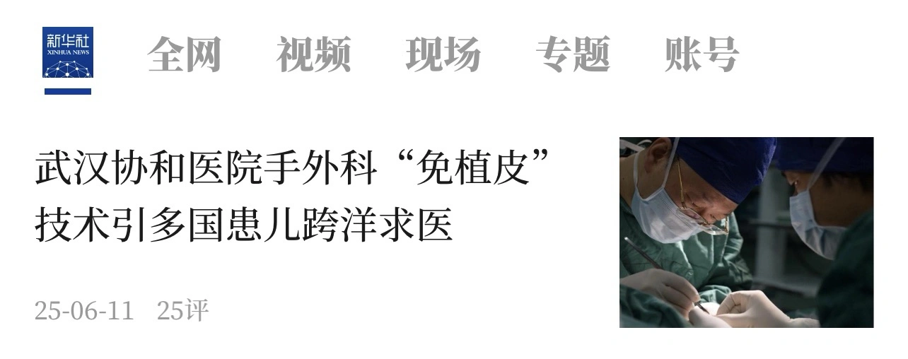 武汉协和医院手外科“免植皮”技术引多国患儿跨洋求医