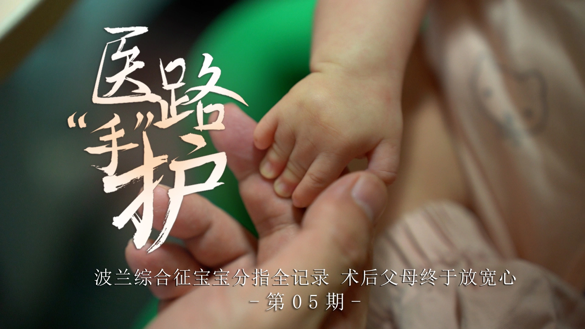 医路手护第05期：波兰综合征宝宝分指全记录，术后父母终于放宽心